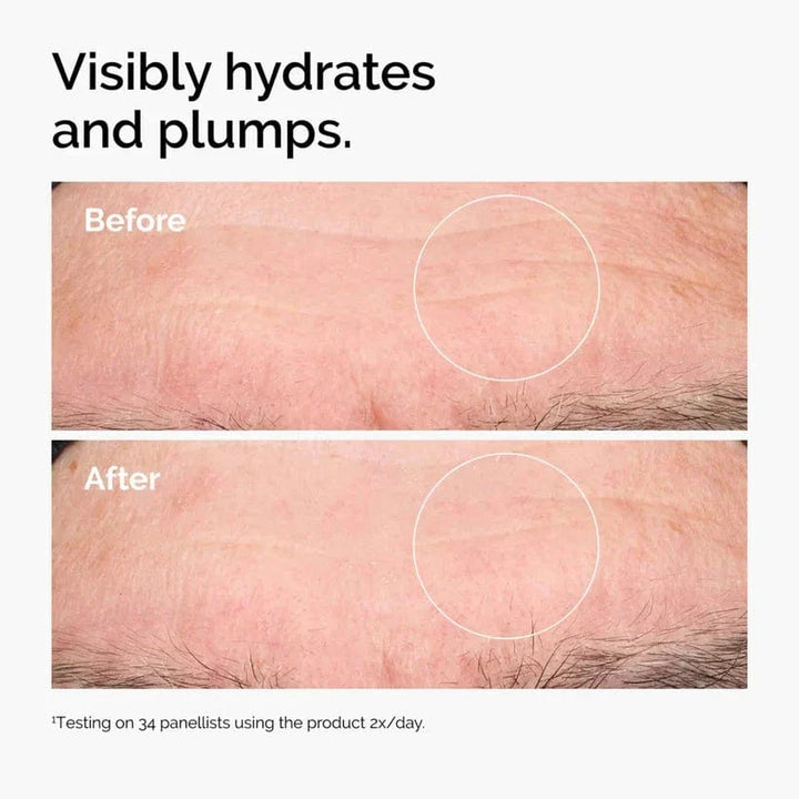 Buy Original The Ordinary Hyaluronic Acid 2% + B5 30ml - Online at Best Price in Pakistan